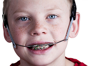 Jaw Closure Disorders